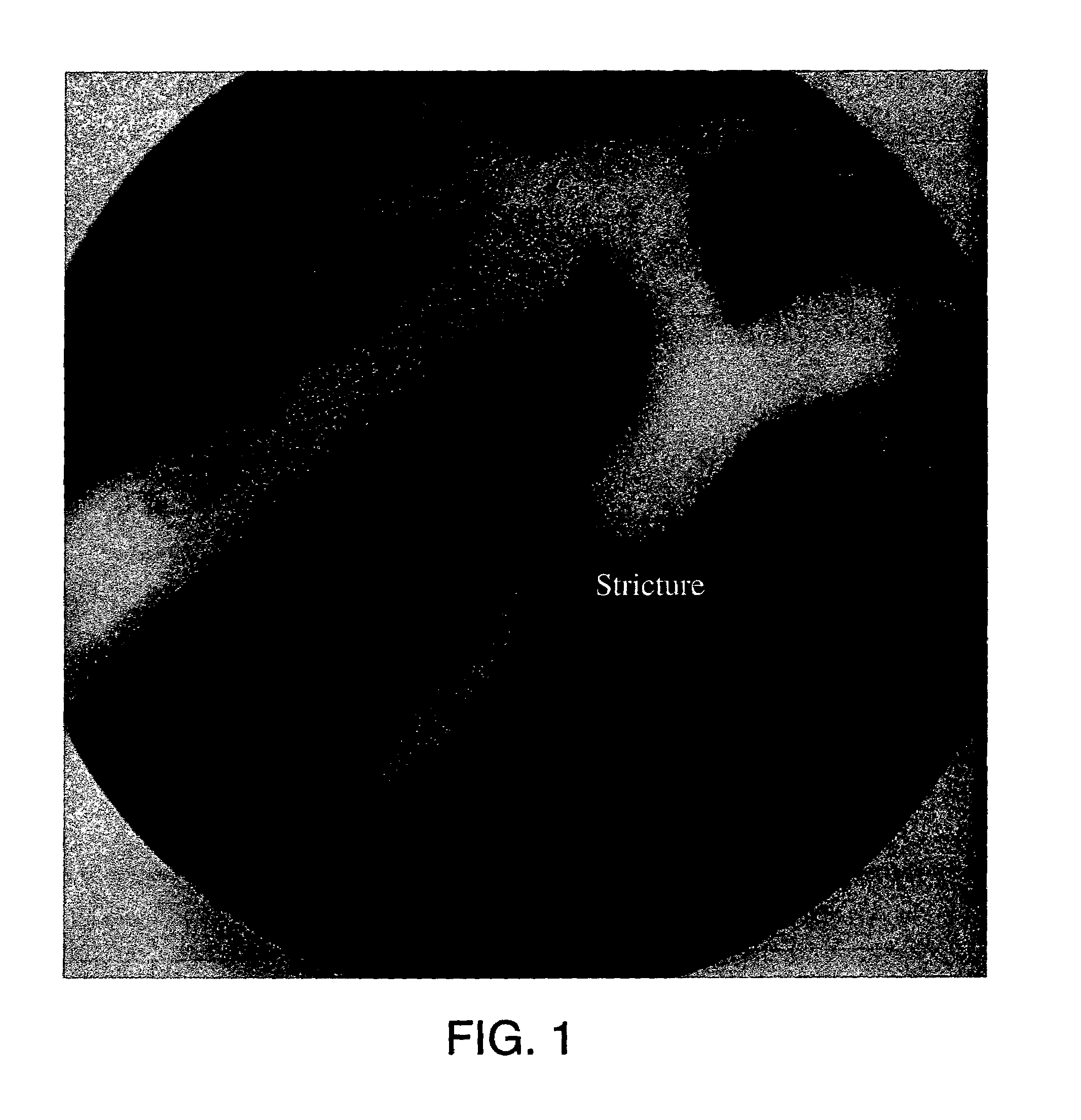 Methods for treating an artery or vein in a human subject