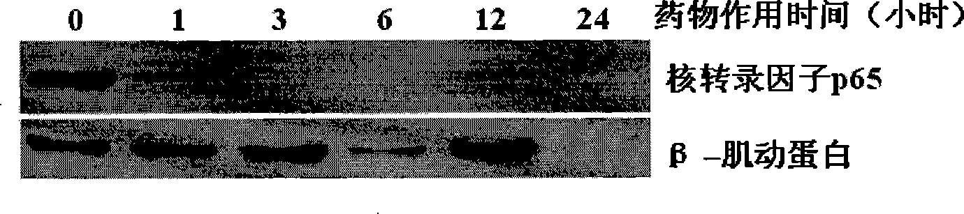 Berbamine derivative and application of salt thereof