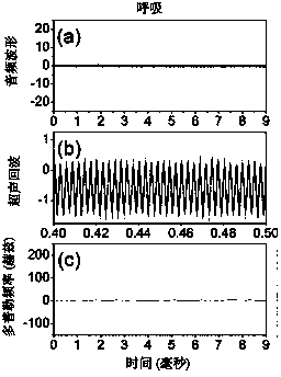 Vocal-cord vibration nondestructive measurement method utilizing natural sound track ultraphonic waveguide effect