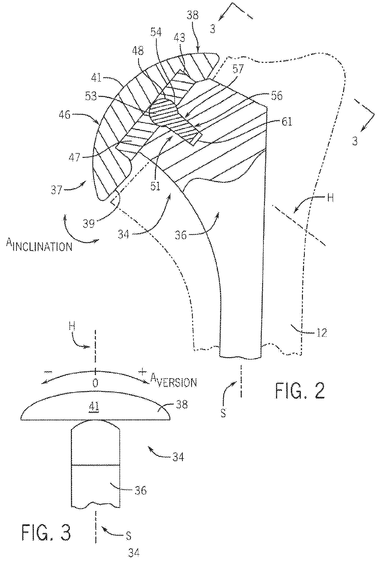 Shoulder Prosthesis With Variable Inclination Humeral Head Component