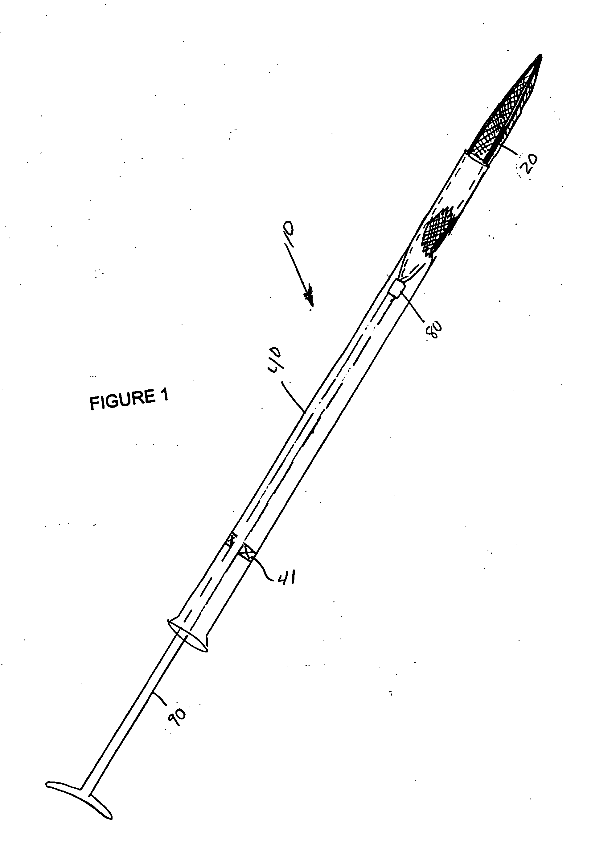 Laparoscopic stone safety device and method