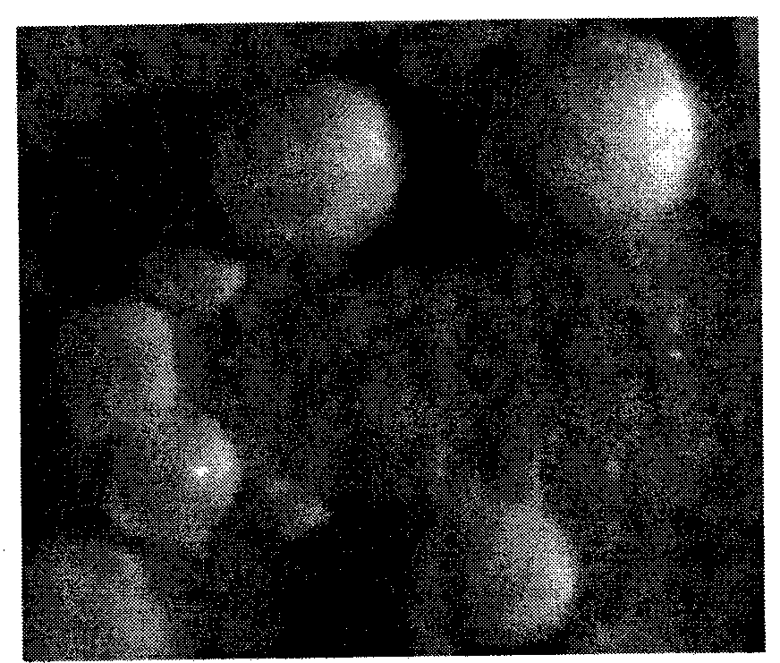 Preparation method of hydroxy apatite / polylactic acid / chitosan composite microballoon