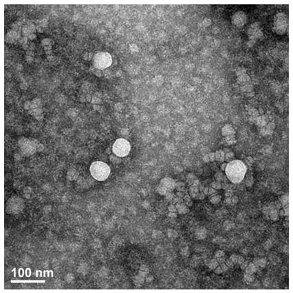 In vitro method for early detection of severity of aneurysmal subarachnoid haemorrhage and prognosis