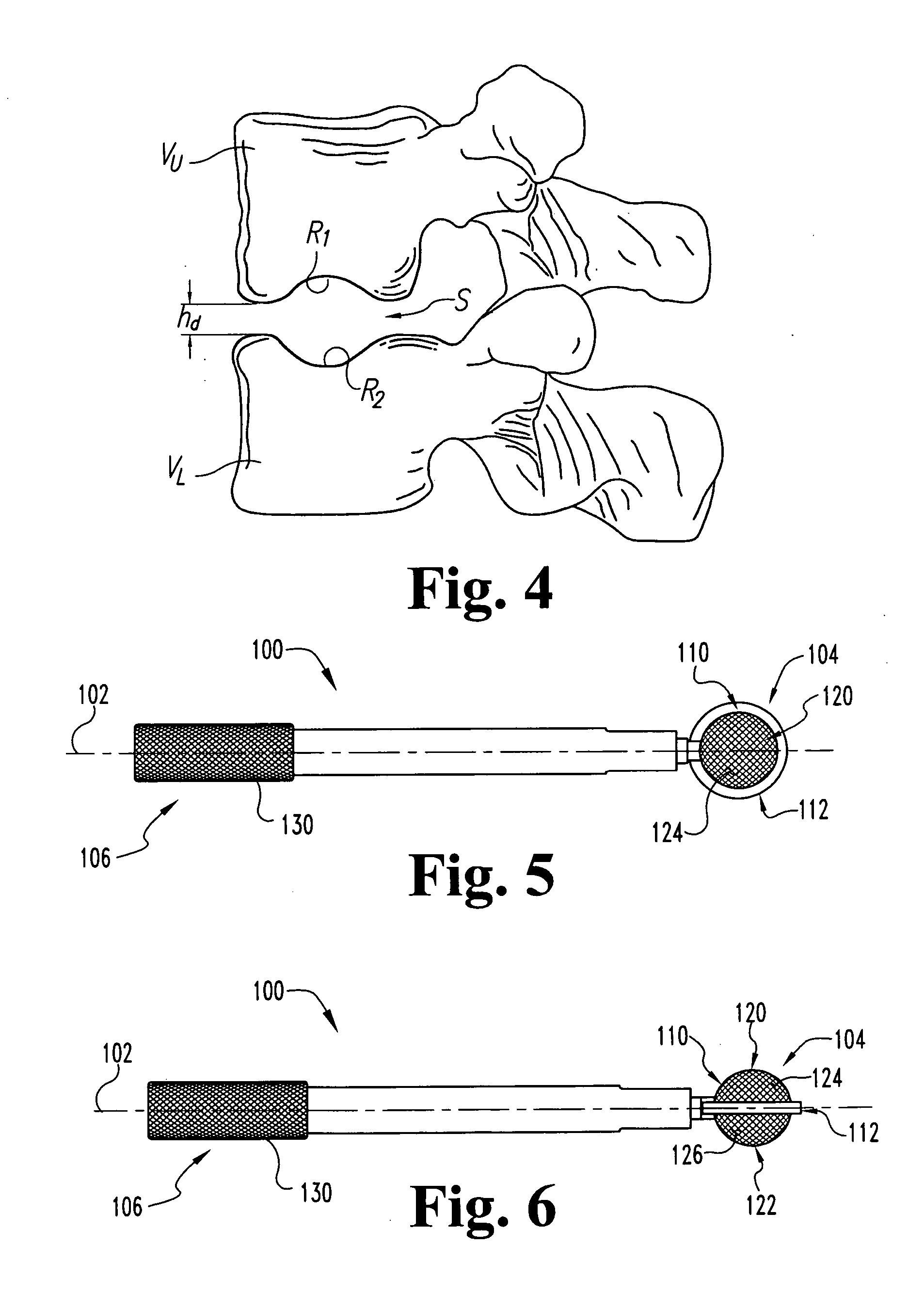 Expandable artificial disc and associated methods and instrumentation