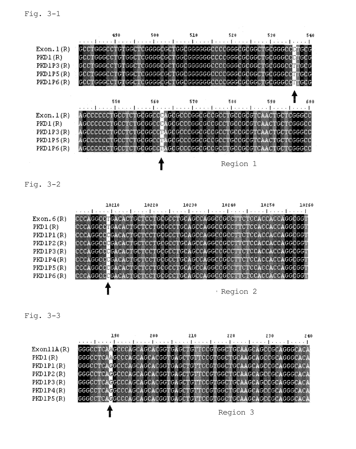 Primer set and method for amplifying exons of pkd1 gene and pkd2 gene