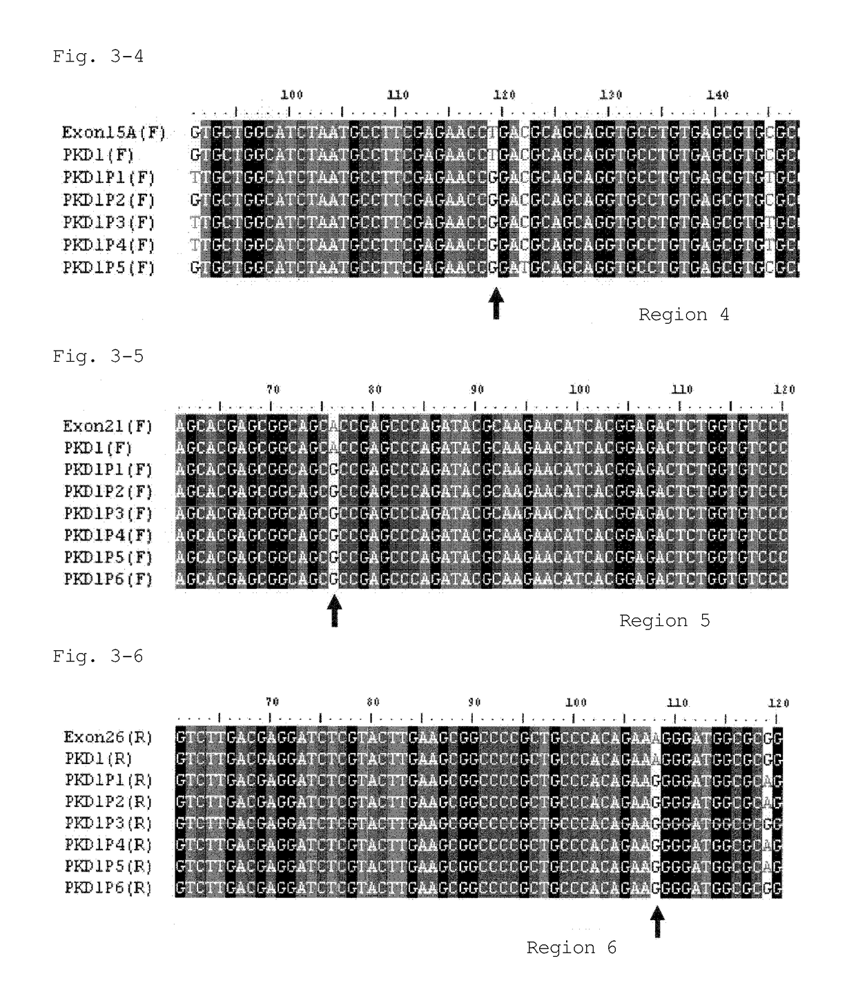 Primer set and method for amplifying exons of pkd1 gene and pkd2 gene