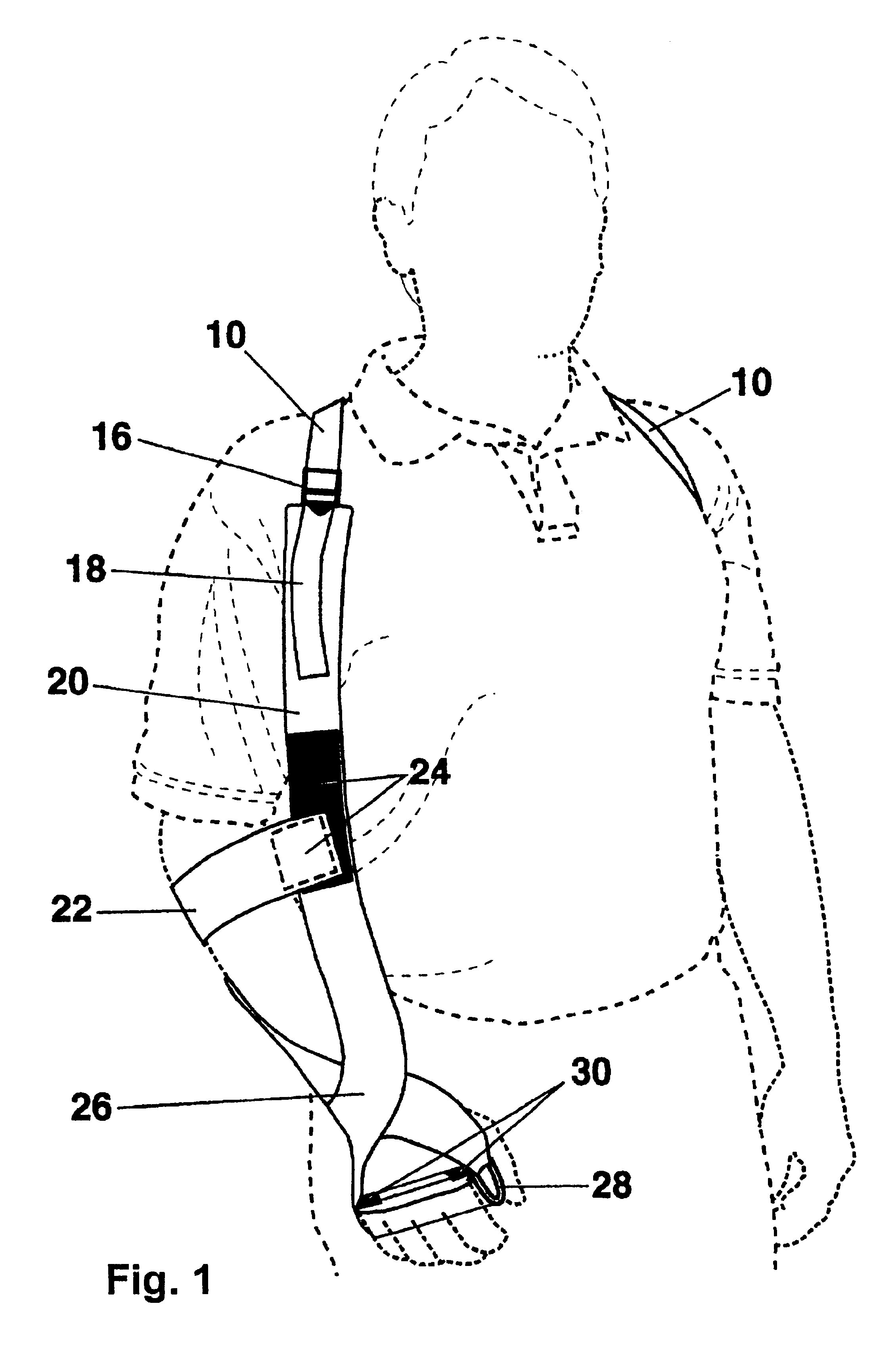 Flaccid upper extremity positioning apparatus