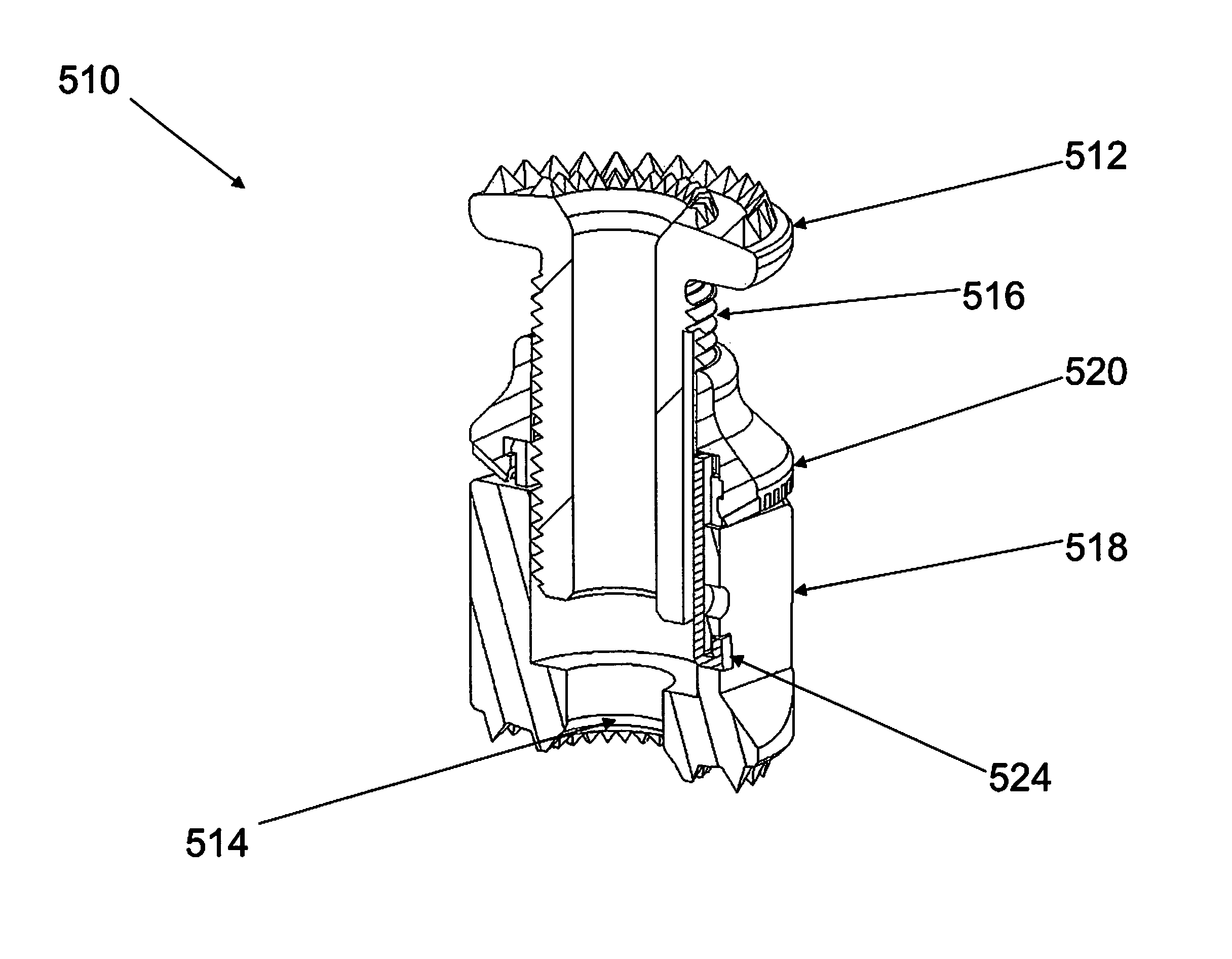 Expandable vertebral prosthesis