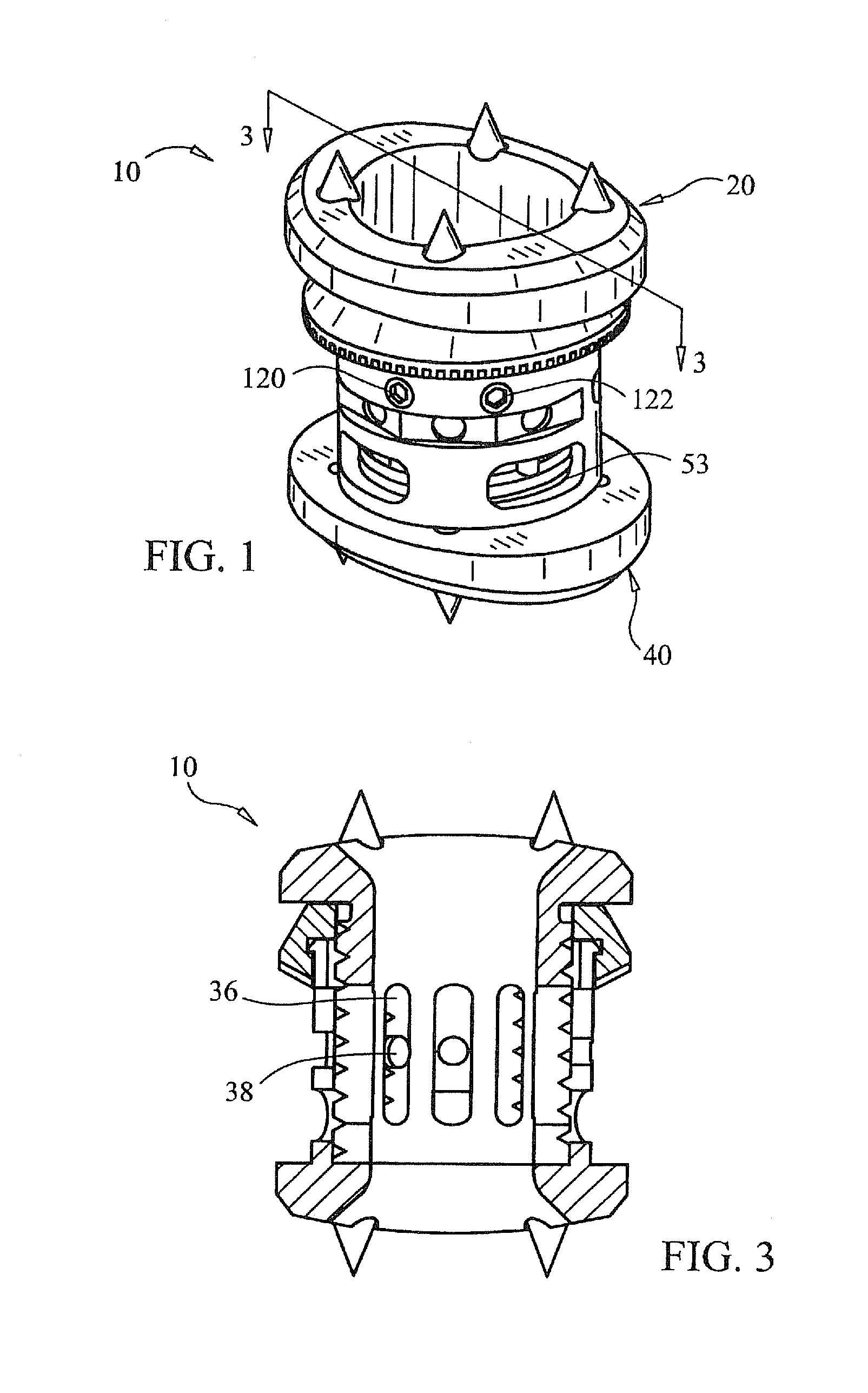 Expandable vertebral prosthesis