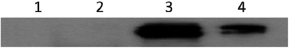 Application of interleukin 35 to preparation of drugs used for treating autoimmune dermatoses, therapeutic drug, and IL-35-Fc fusion protein