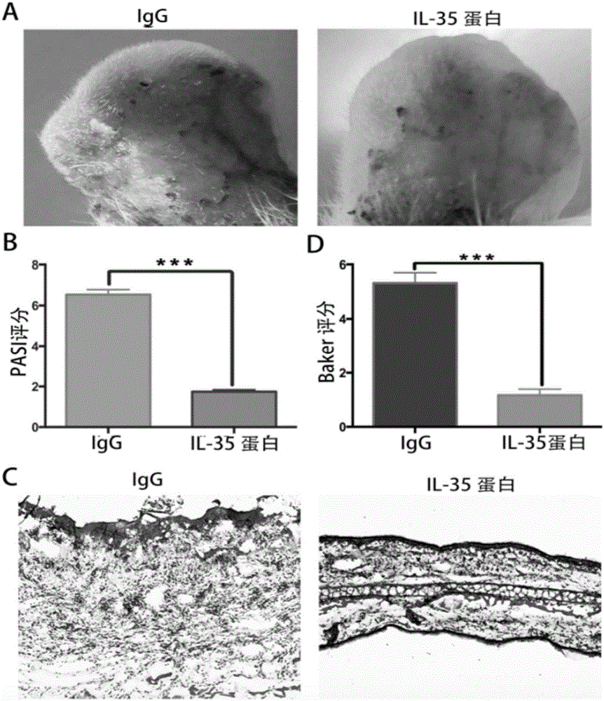 Application of interleukin 35 to preparation of drugs used for treating autoimmune dermatoses, therapeutic drug, and IL-35-Fc fusion protein