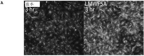 Treatment of diseases mediated by vascular hyperpermeability