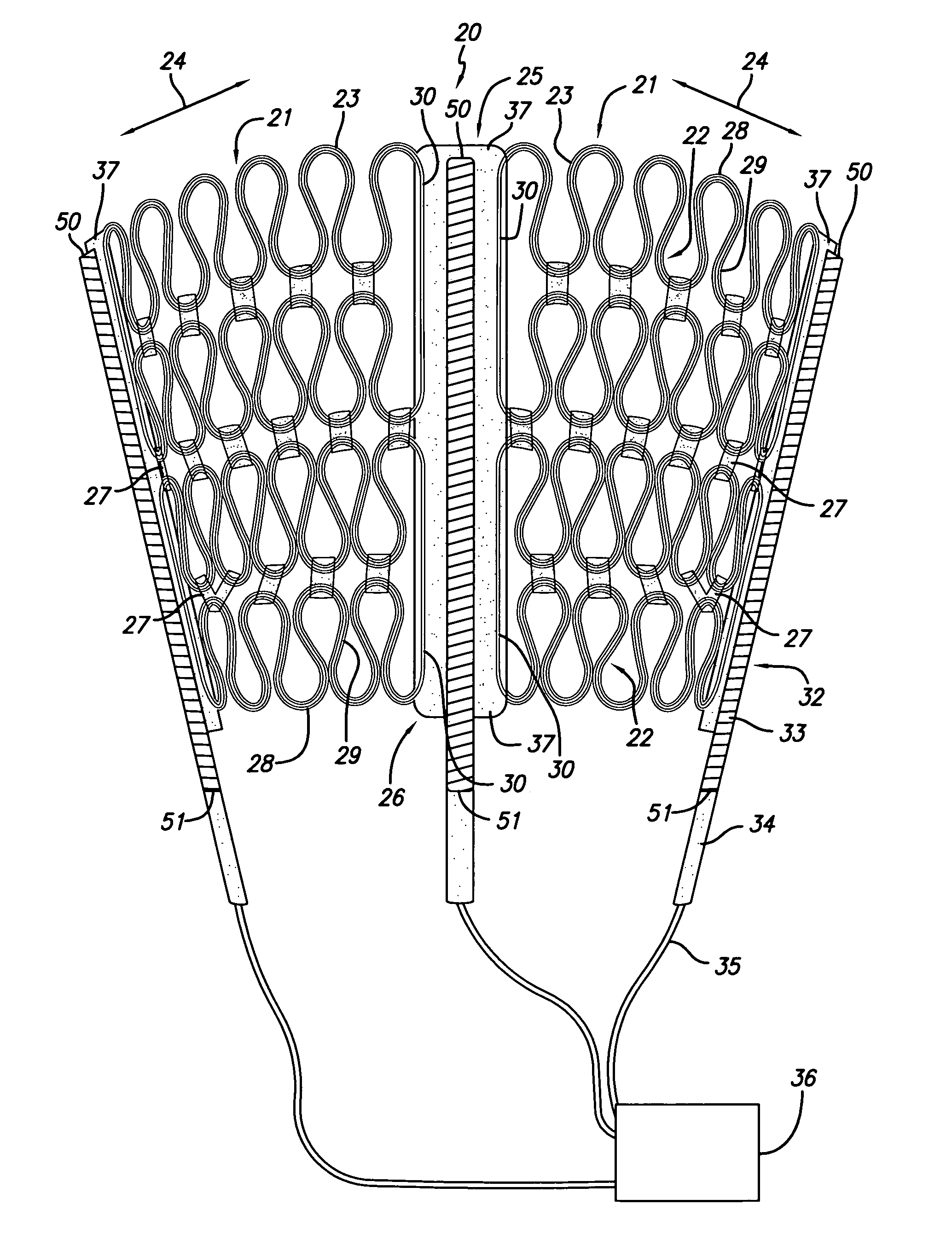 Cardiac harness for treating heart disease