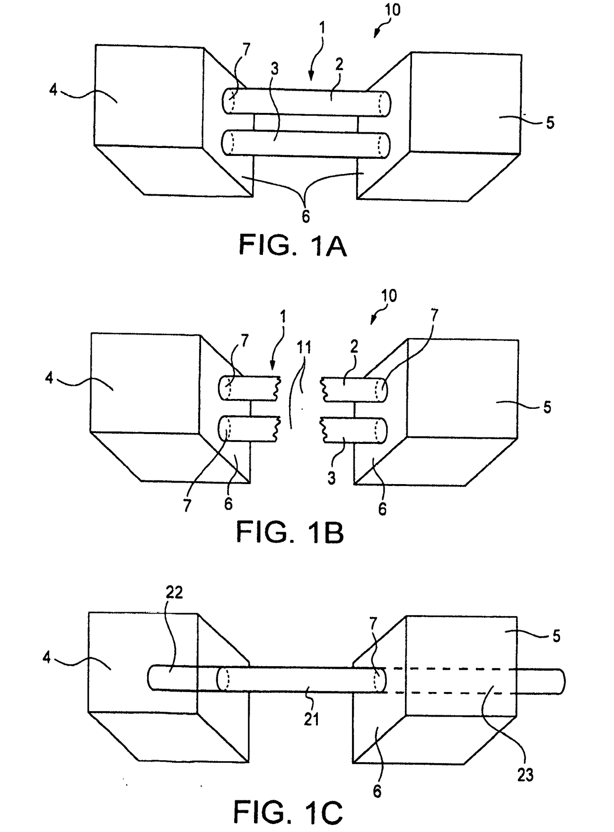 Cortical loop fixation system for ligament and bone reconstruction