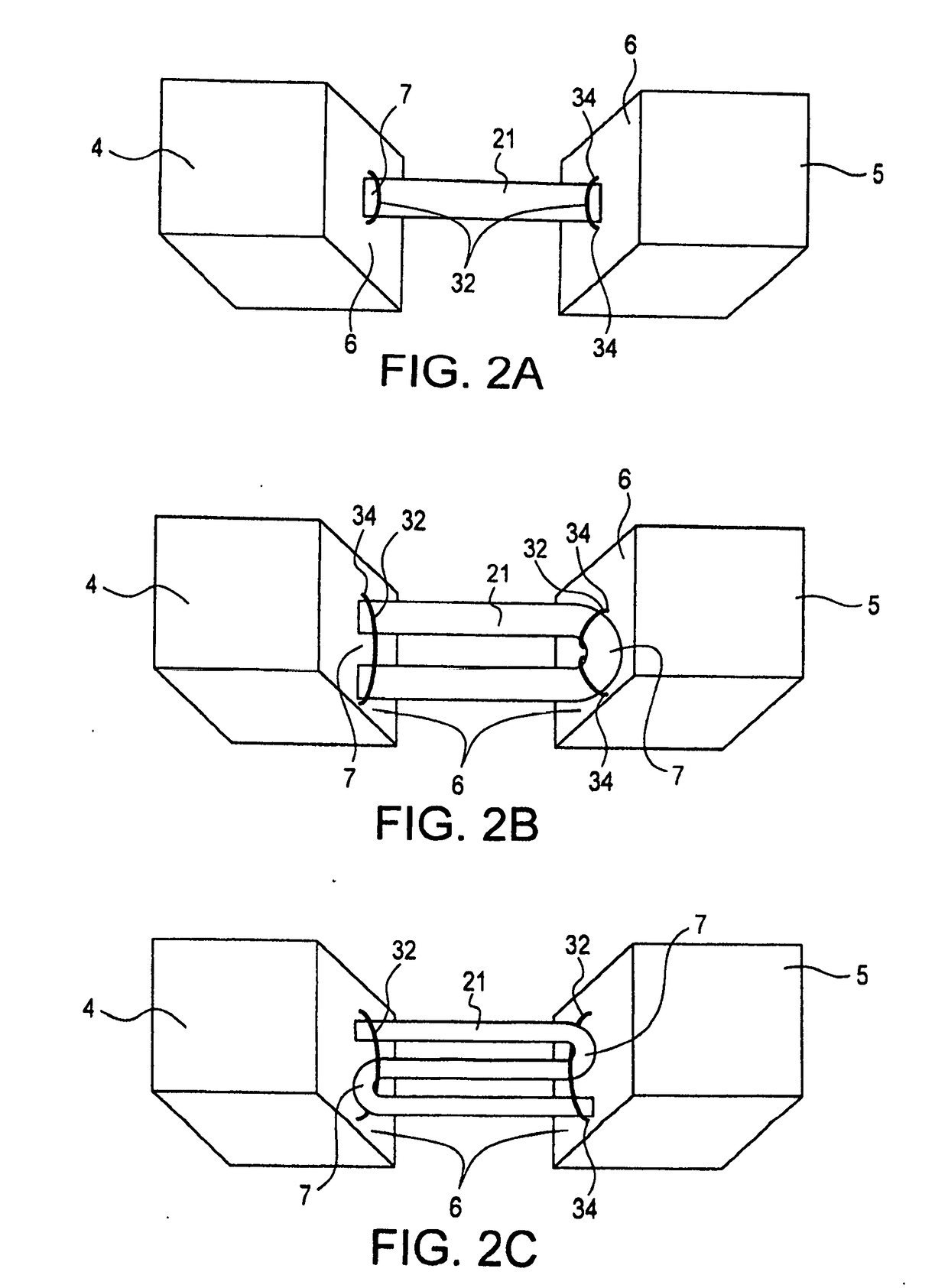 Cortical loop fixation system for ligament and bone reconstruction