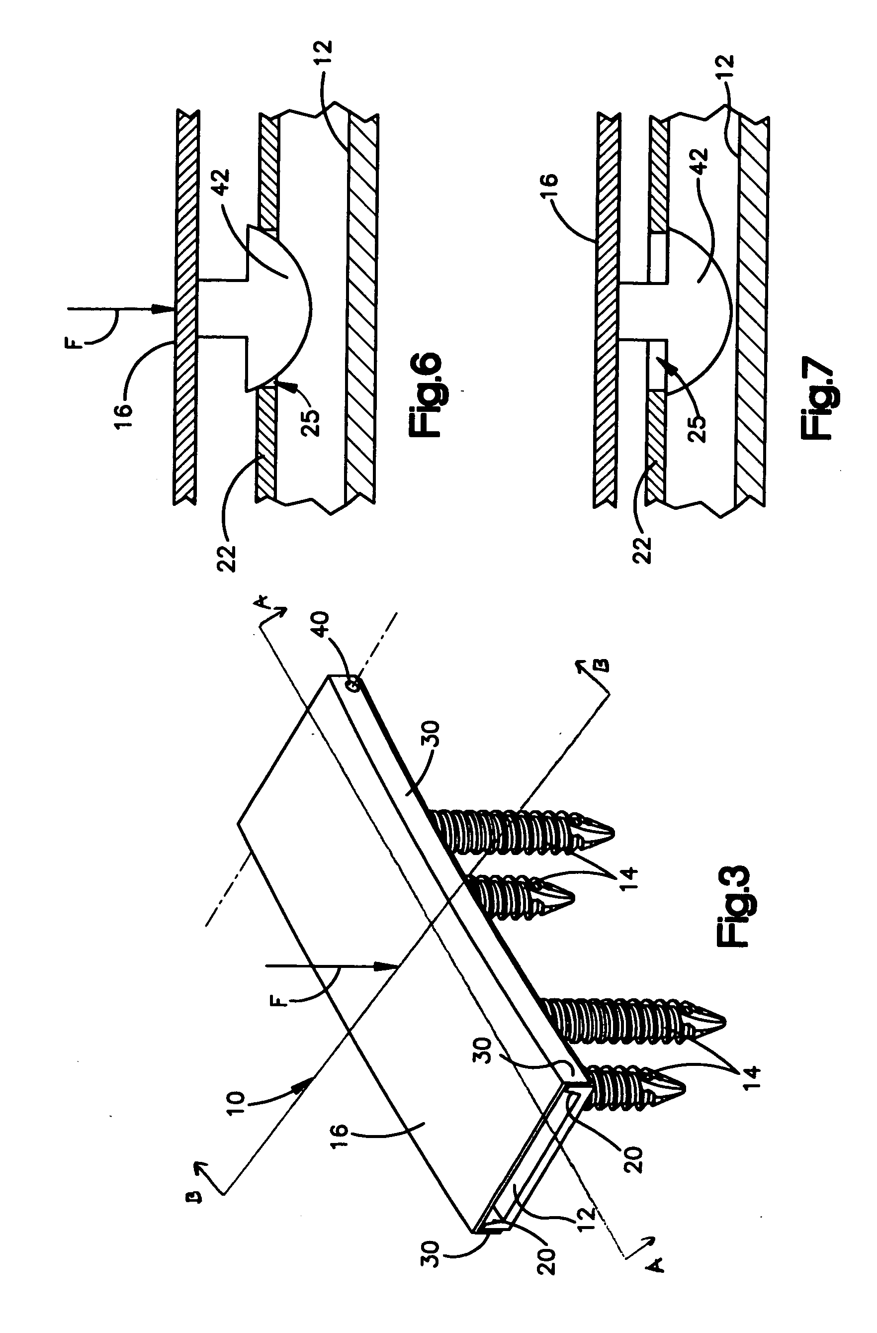 Translational hinged door plate system