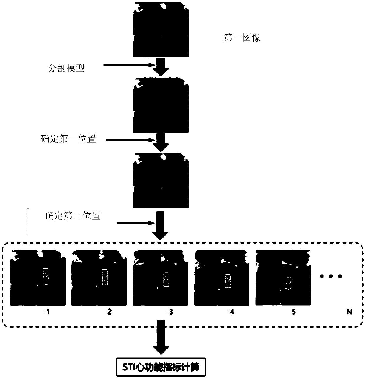 Method, apparatus and device for processing medical image, and medium