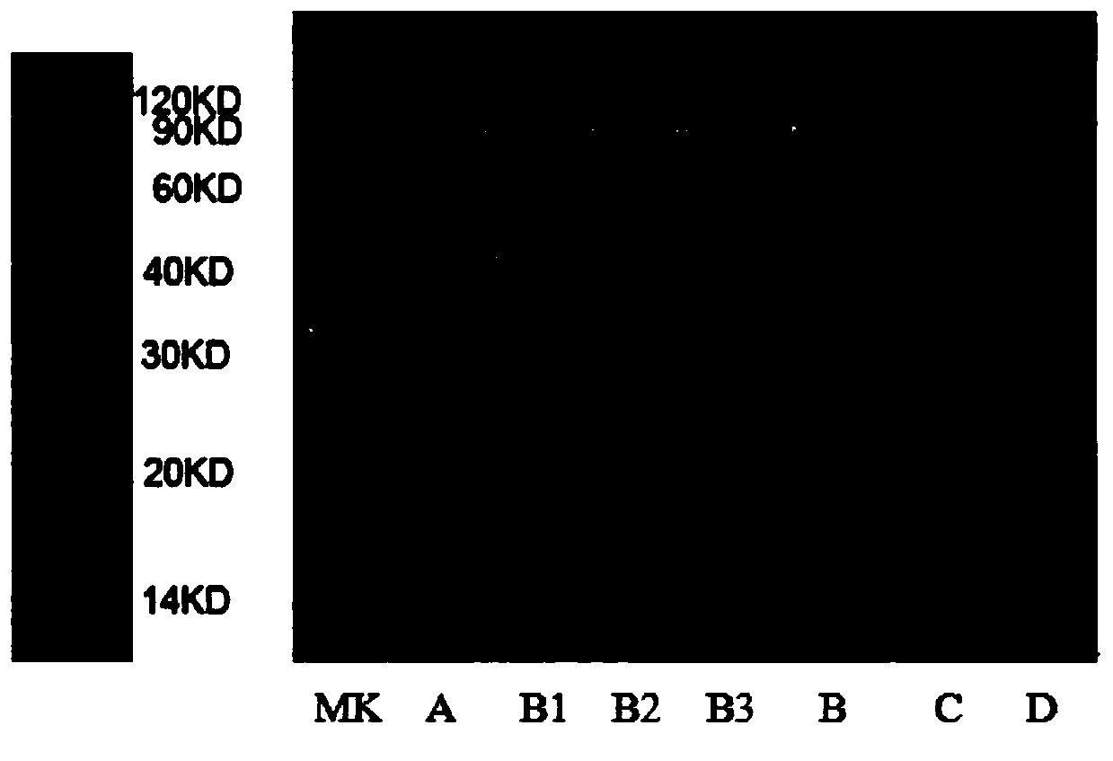 Method for prokaryotic expression of recombinant chicken angiopoietin-like protein 4 and application thereof