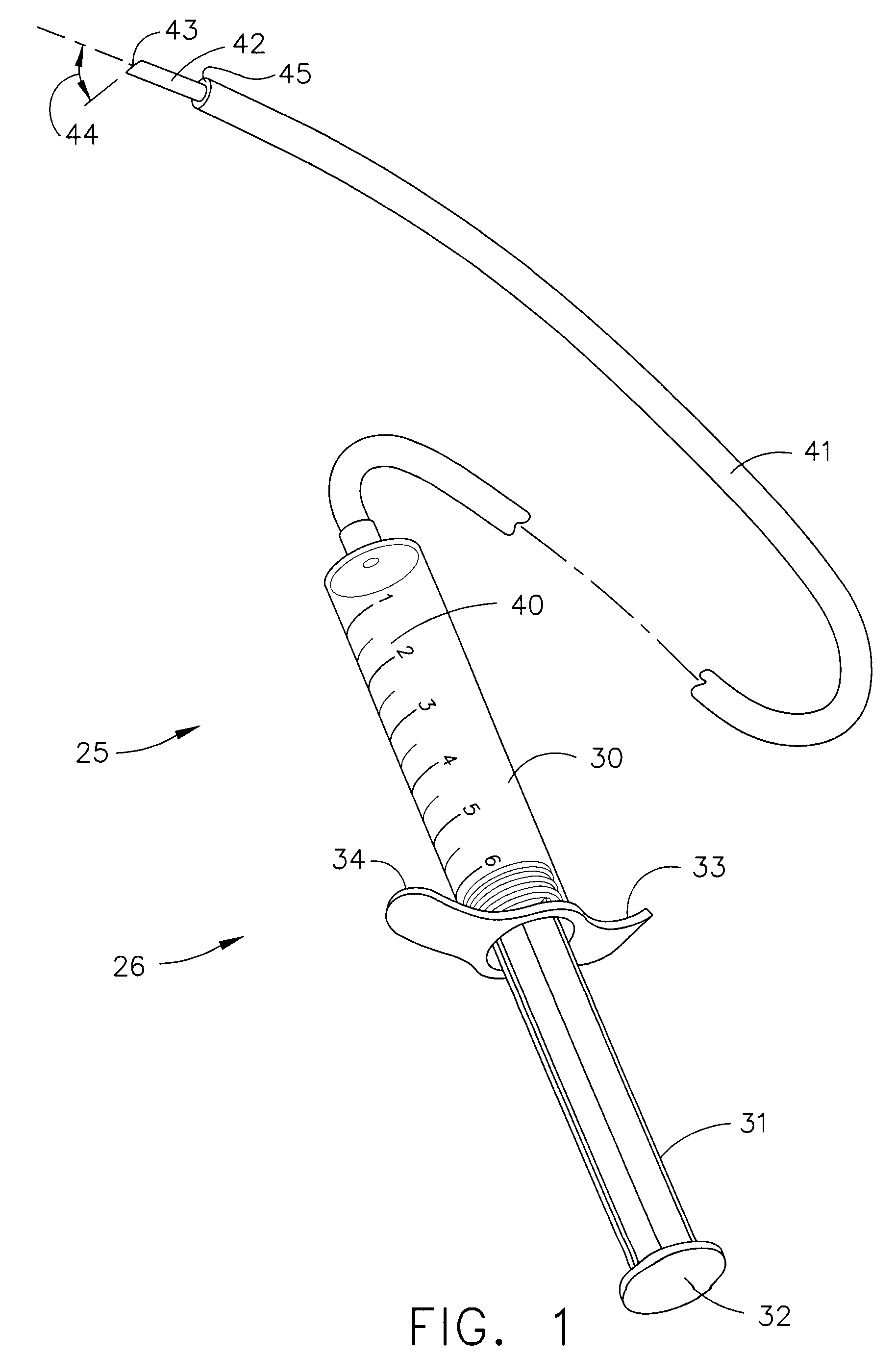 Use of an adhesive as an intestinal barrier for bariatrics