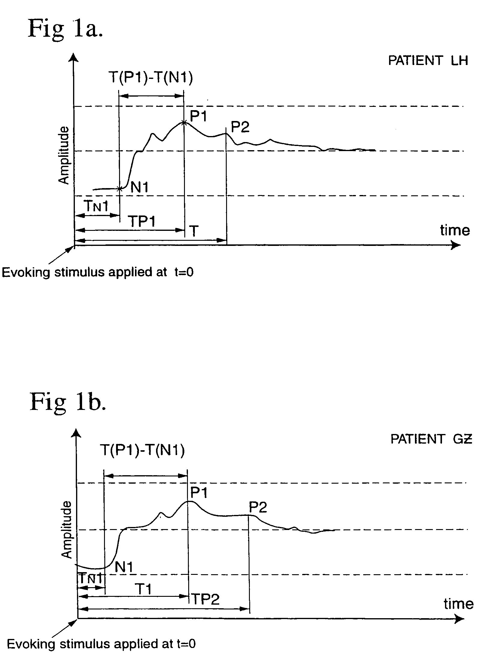 Method and apparatus for optimising the operation of a cochlear implant prosthesis