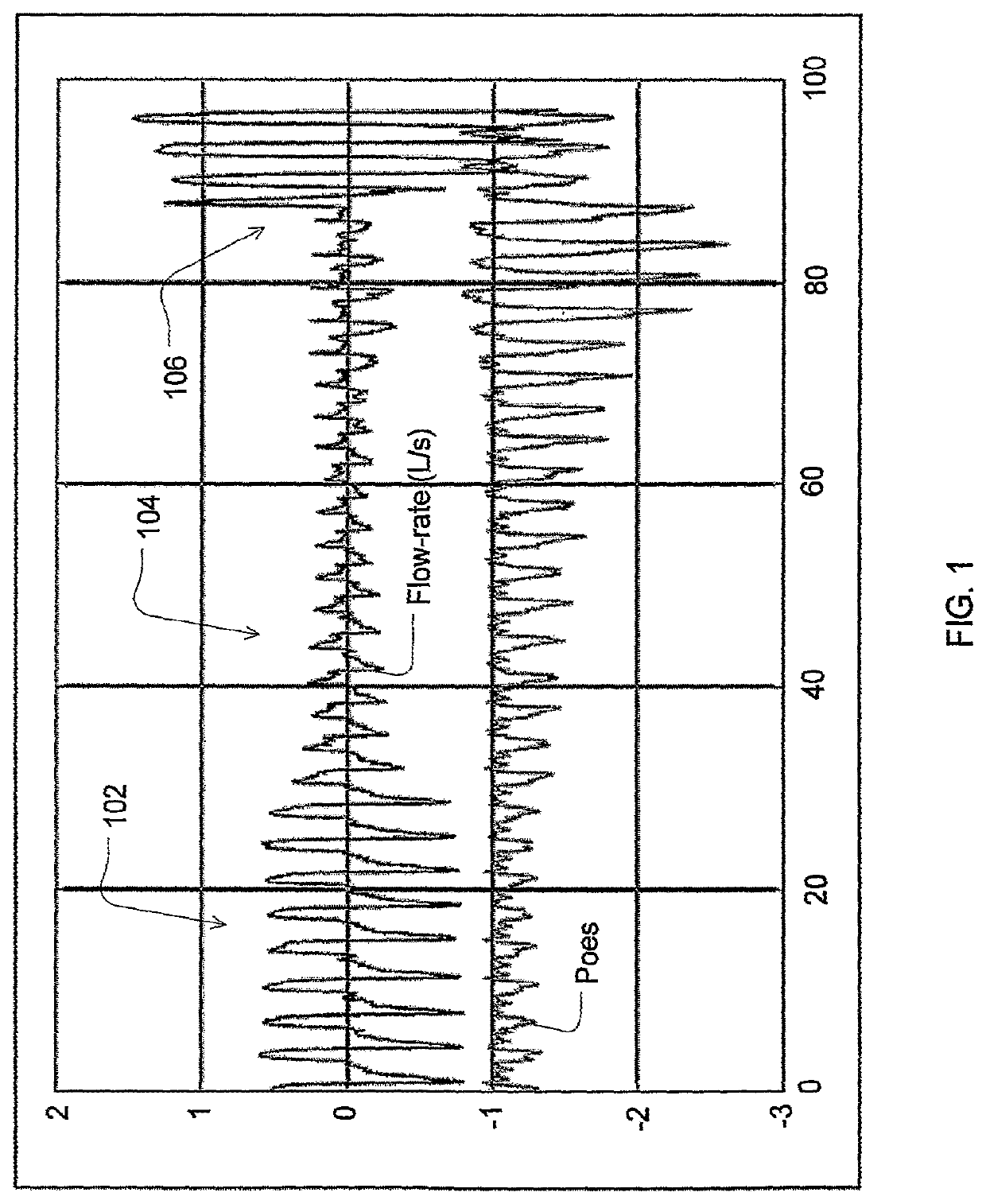 Automated control for detection of flow limitation