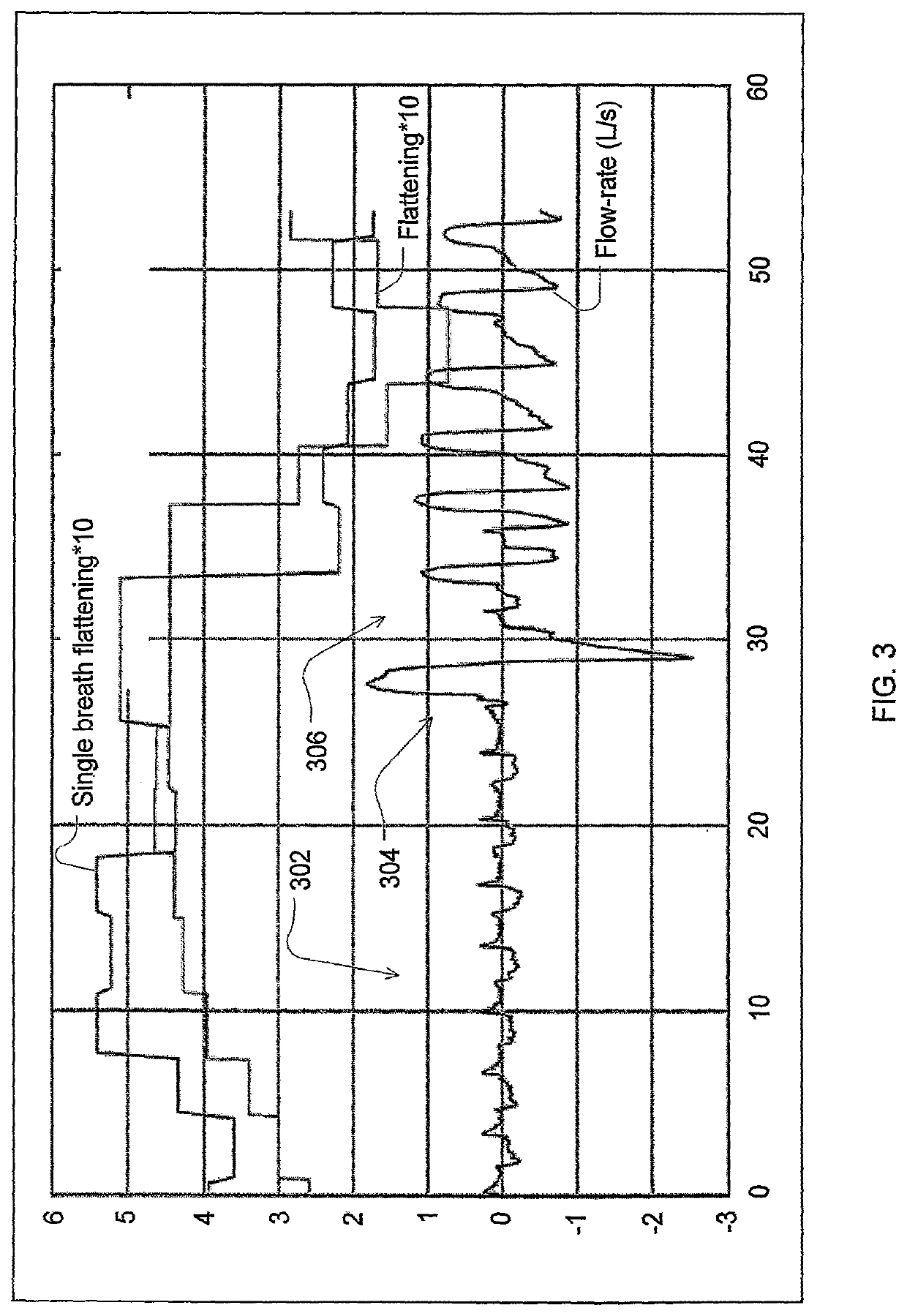 Automated control for detection of flow limitation