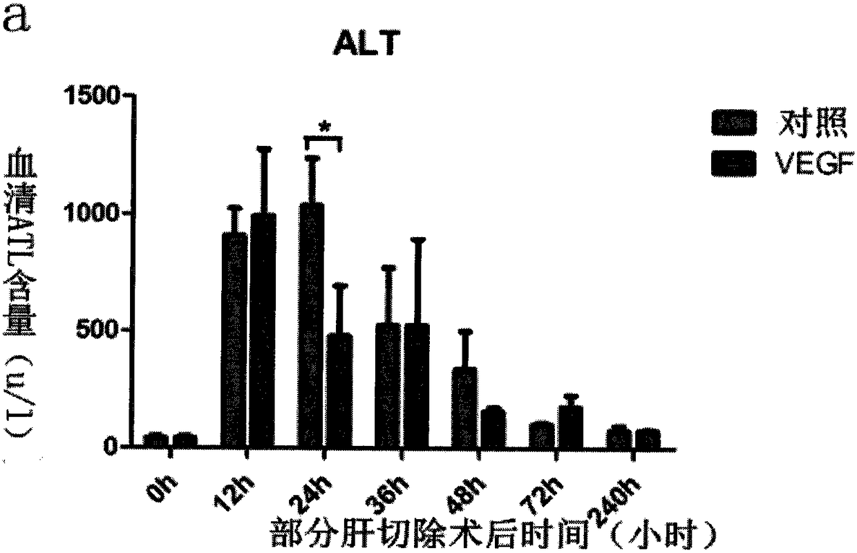 Vegf-loaded hydrogel fiber membrane for liver regeneration and preparation method thereof