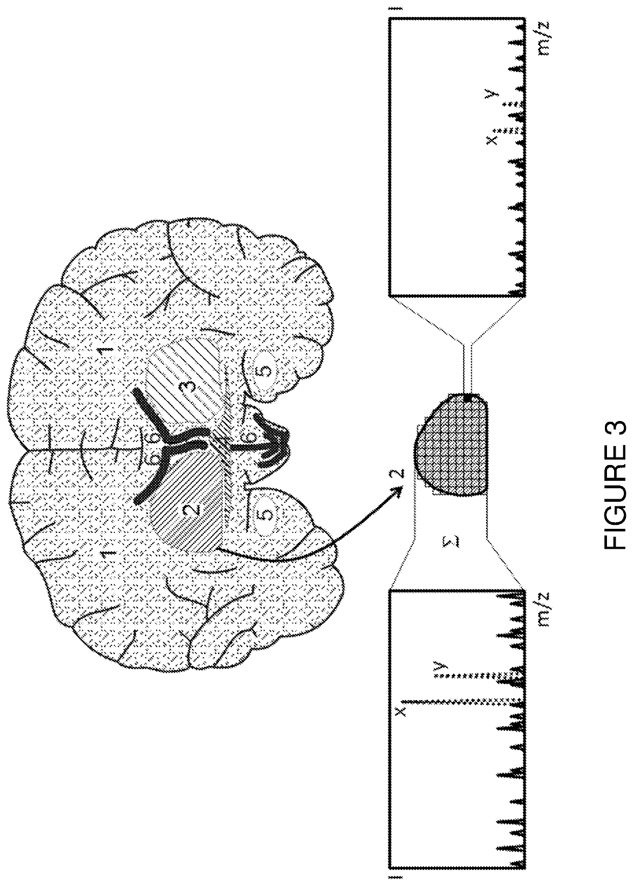 Mass spectrometric determination of particular tissue states