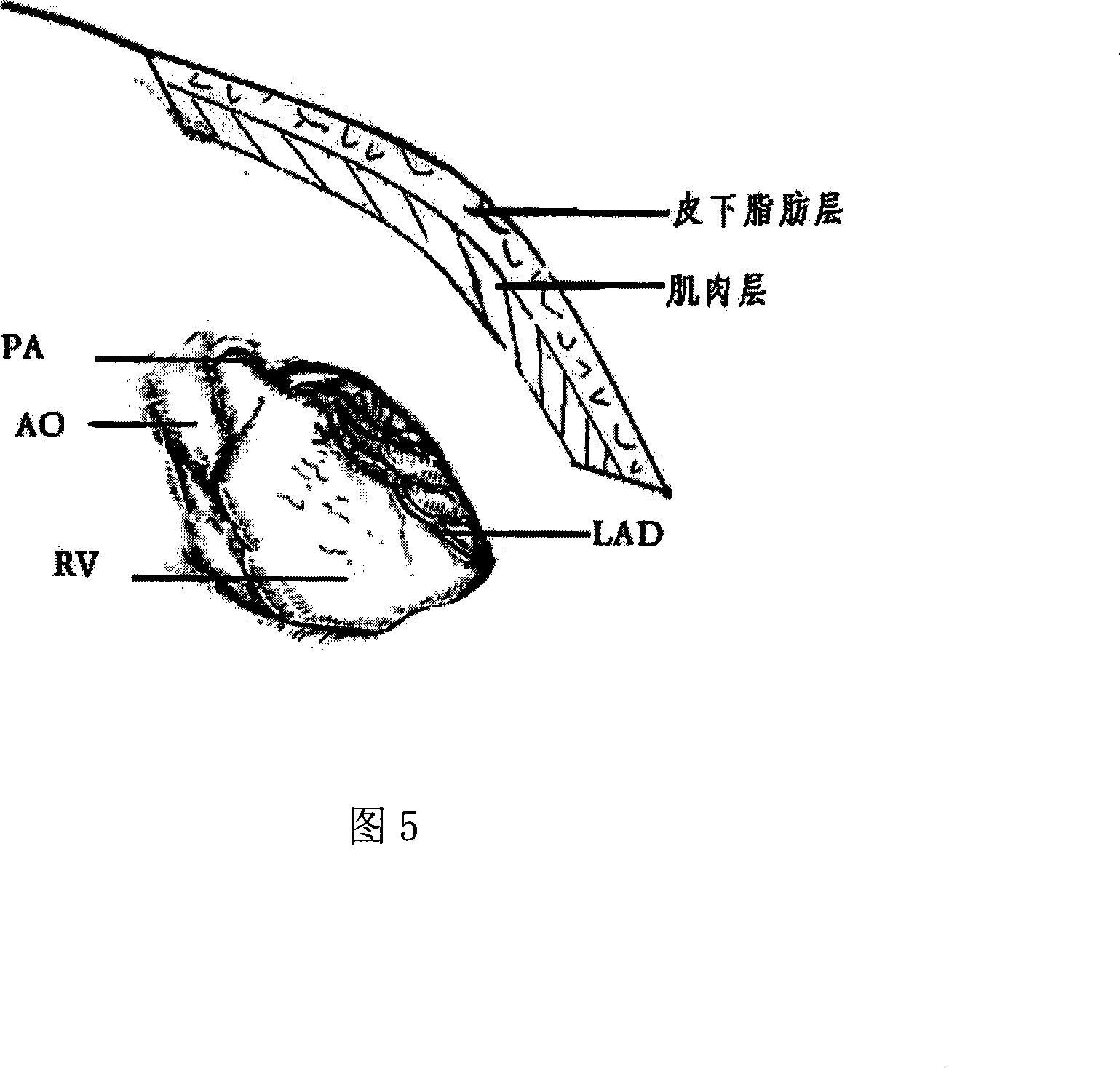 Improved myocardial infarction re-perfusion model, producing and using method thereof