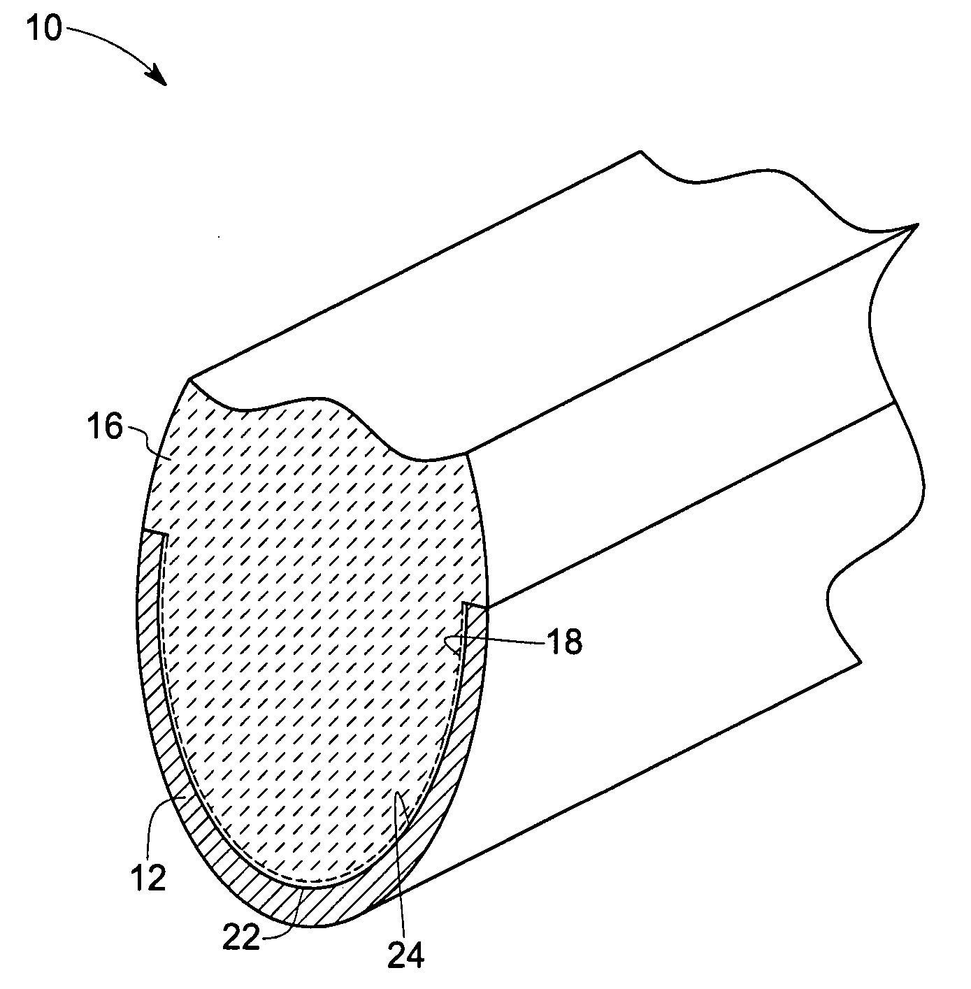 Method for roughening metal surfaces and article manufactured thereby