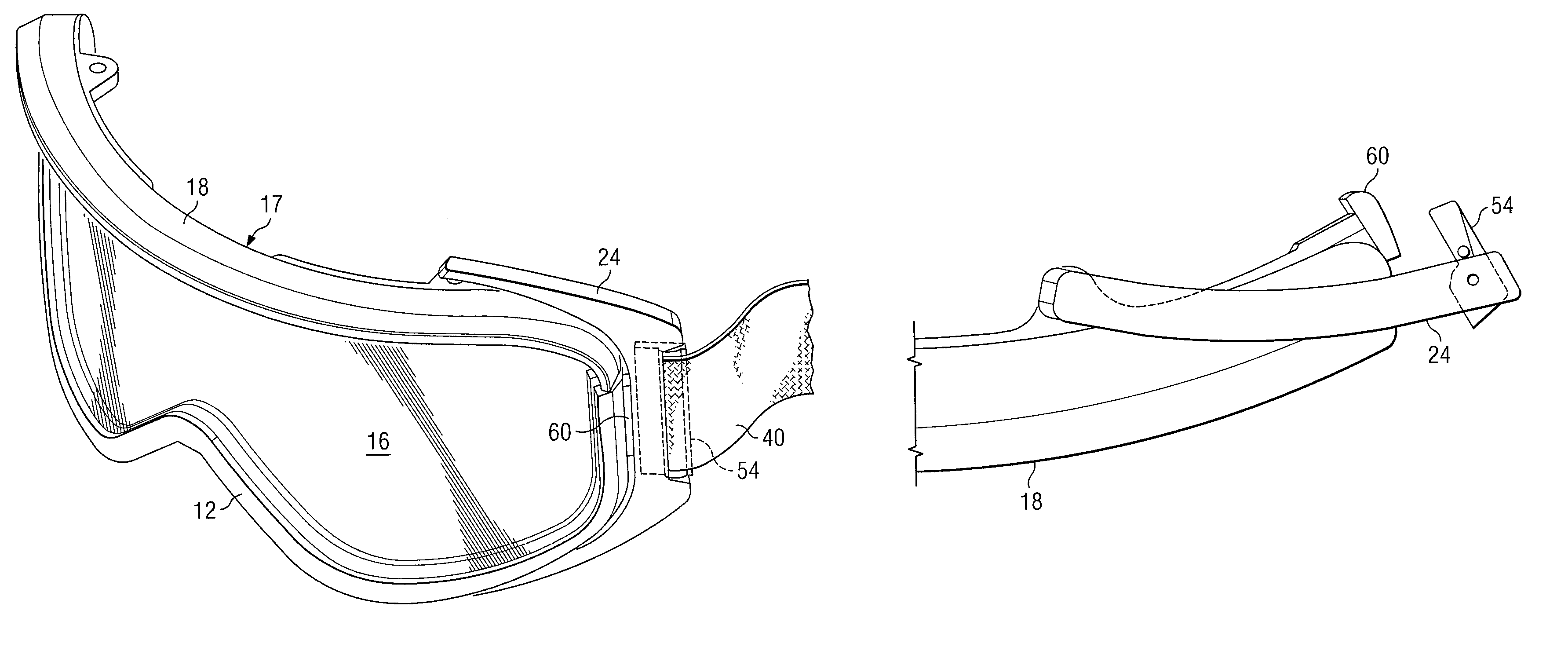 Lens replacement system