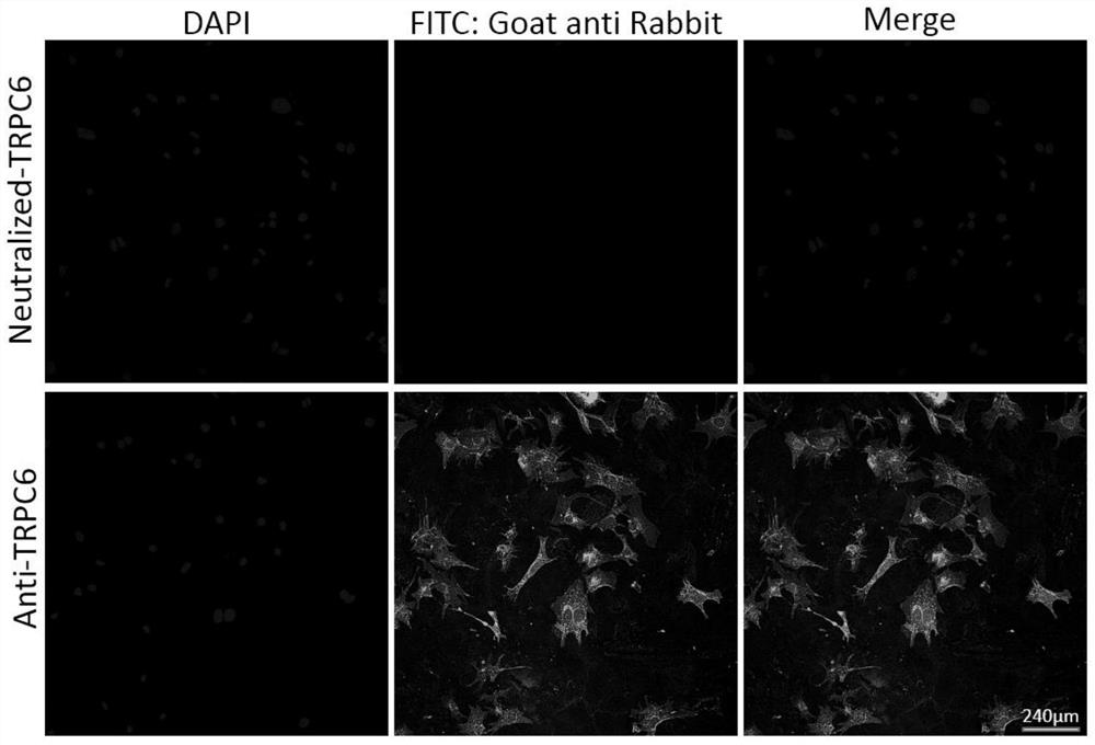 Cell membrane transient receptor potential C6 channel immunogenic oligopeptide as well as vaccine and anti-ventricular fibrosis pharmaceutical application of cell membrane transient receptor potential C6 channel immunogenic oligopeptide