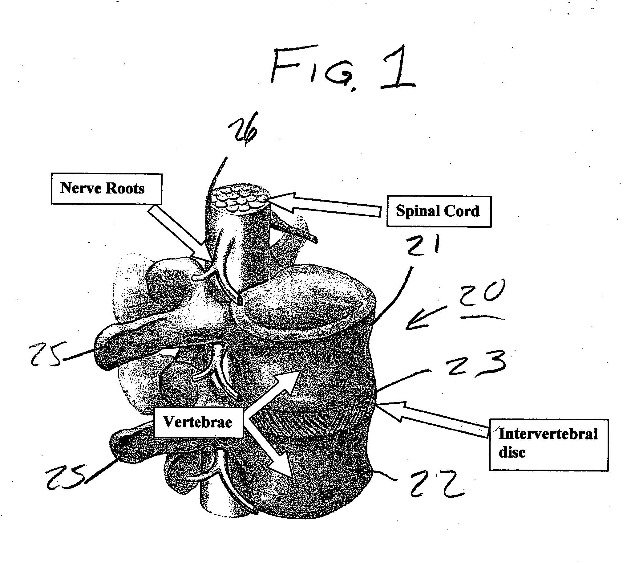 Method and composition for repair and reconstruction of intervertebral discs and other reconstructive surgery