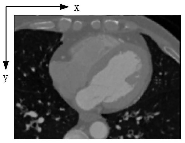 Blood vessel tracking method, coronary artery image segmentation method, medium and electronic equipment