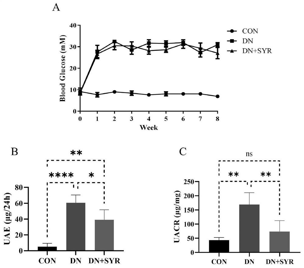 Application of syringaresinol in preparation of medicine for preventing and treating diabetic nephropathy