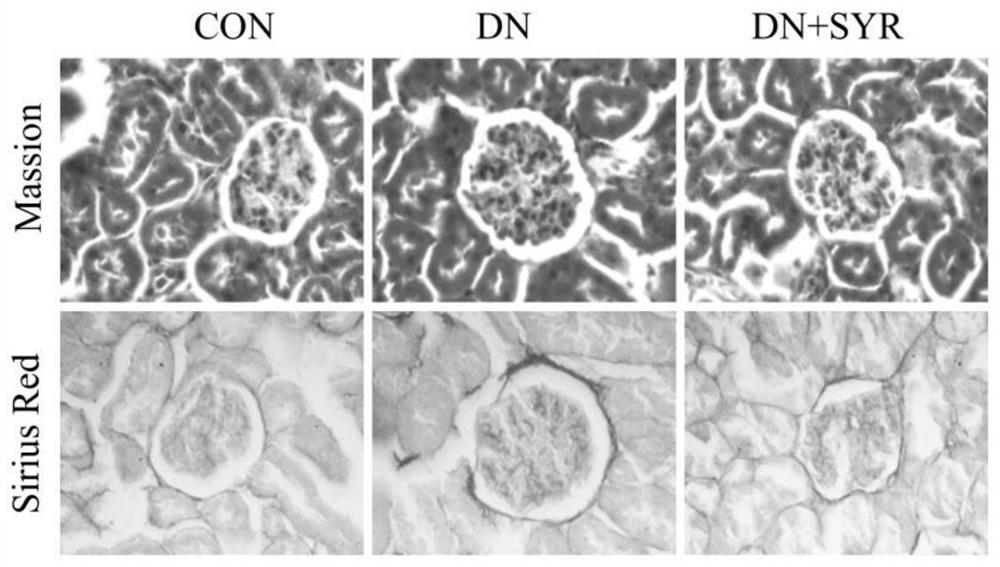 Application of syringaresinol in preparation of medicine for preventing and treating diabetic nephropathy