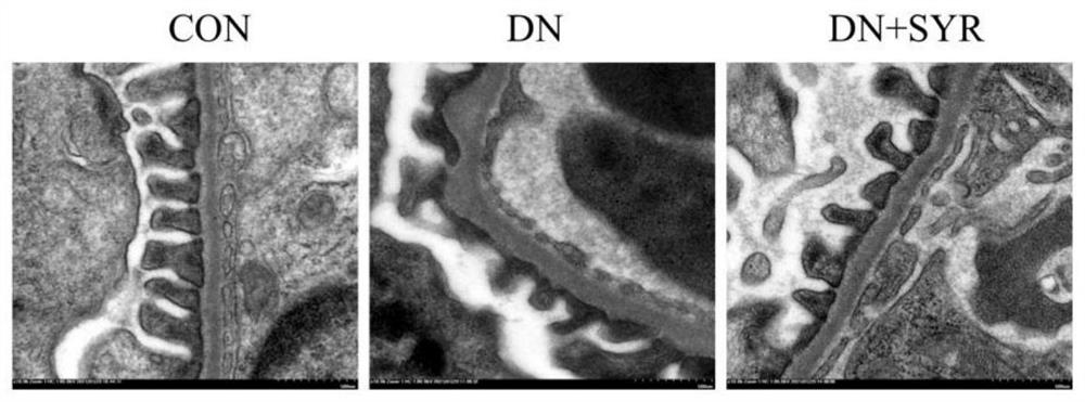 Application of syringaresinol in preparation of medicine for preventing and treating diabetic nephropathy