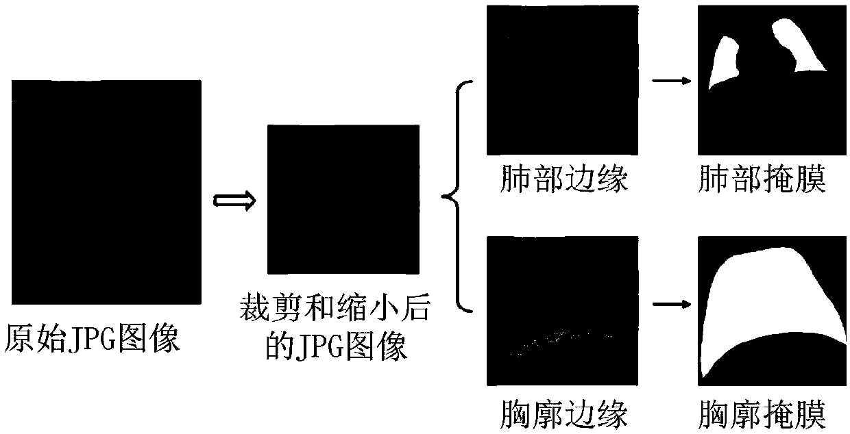 Chest radiograph segmentation and processing method and system and electronic equipment