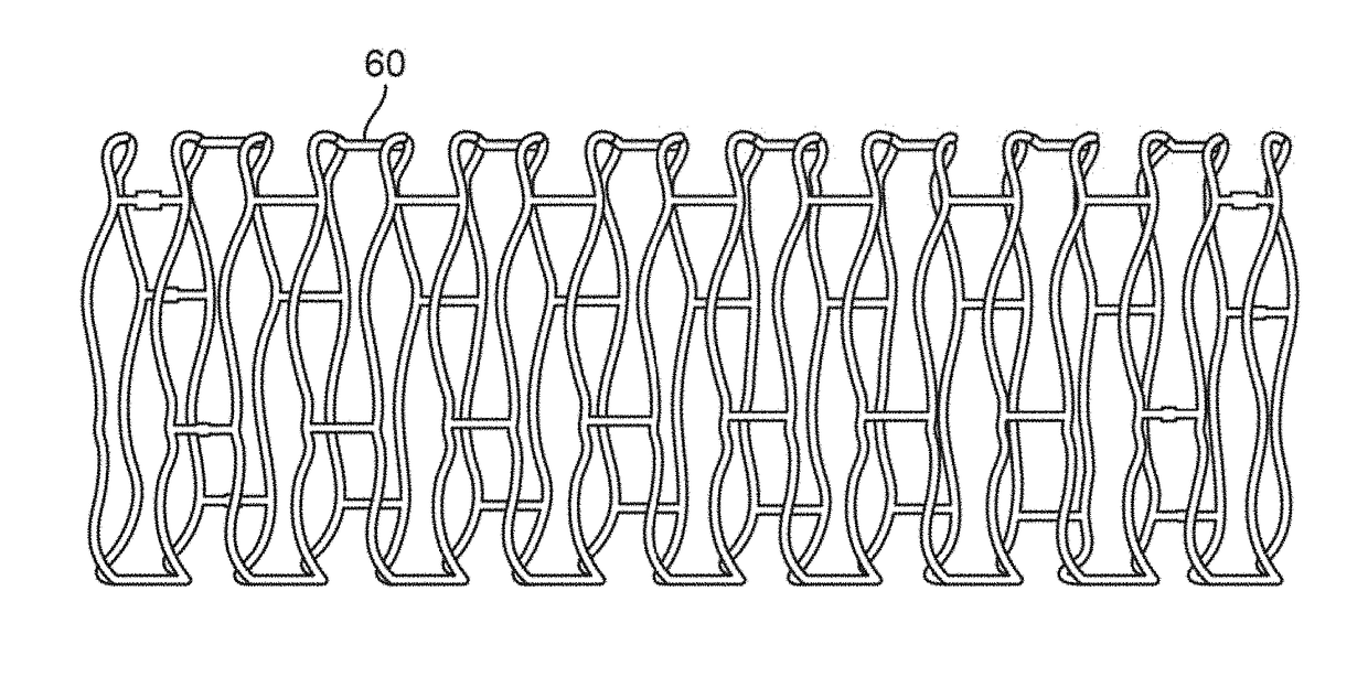 Post deployment radial force recovery of biodegradable scaffolds