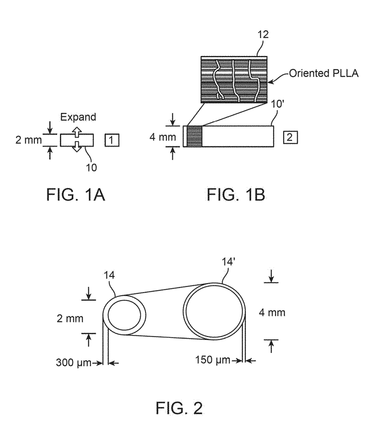 Post deployment radial force recovery of biodegradable scaffolds