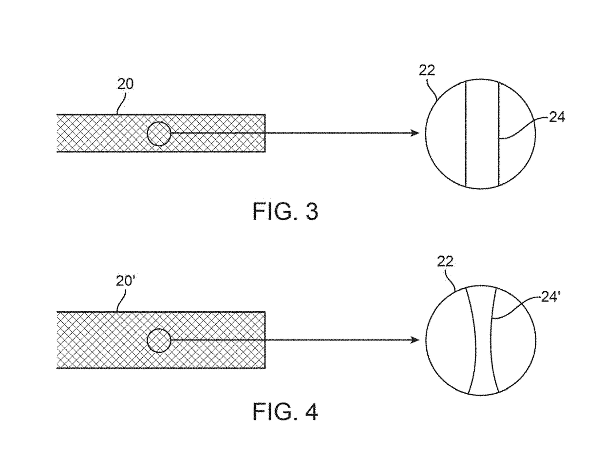 Post deployment radial force recovery of biodegradable scaffolds