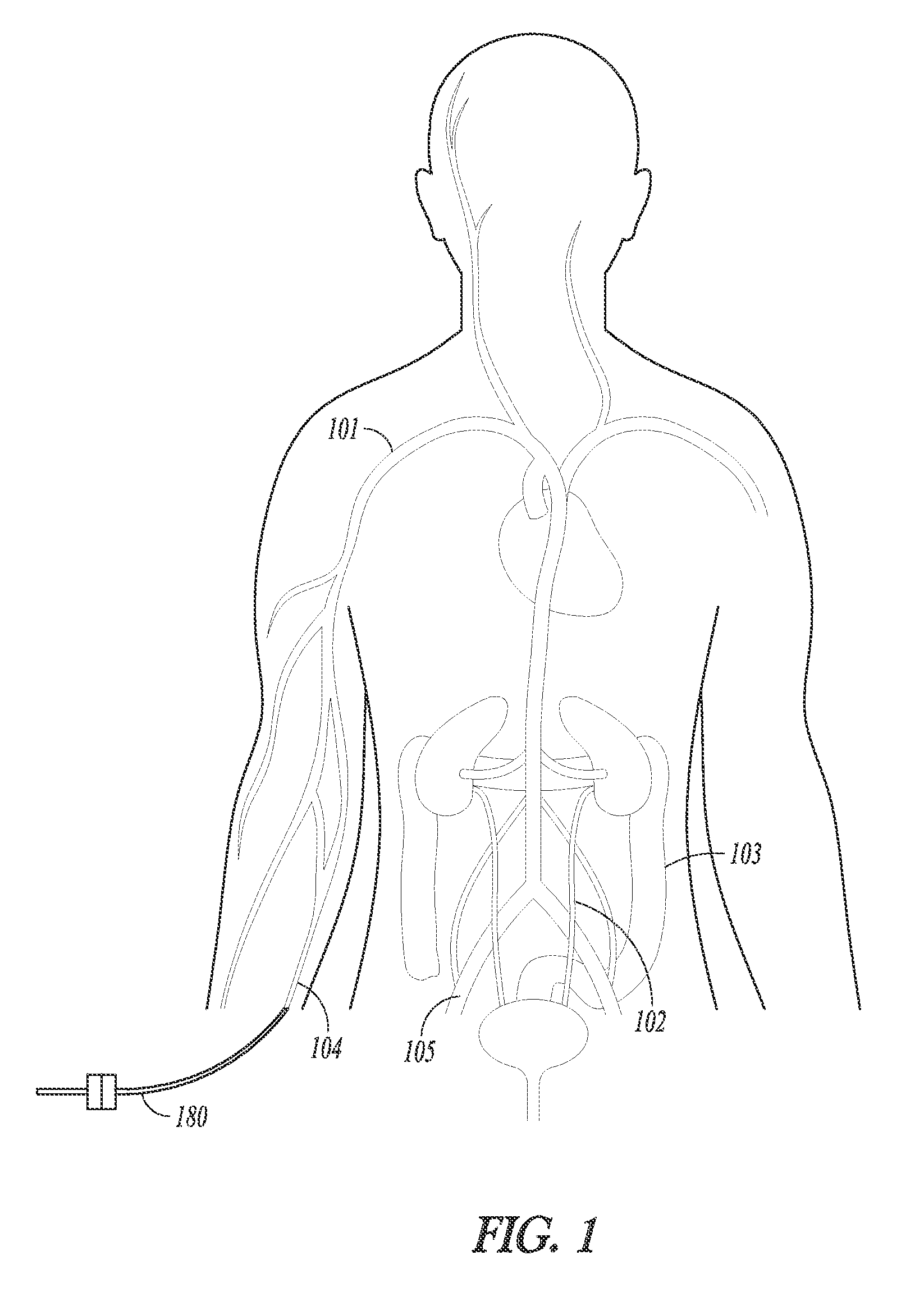 Vascular dilator systems, kits, and methods