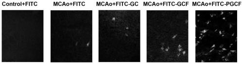 A synthetic peptide for the treatment of neurological diseases