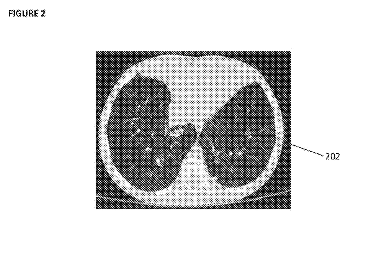 A Method of Analysing an Image for Assessing a Condition of an Organ of a Patient