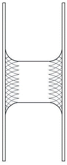 Bilateral single-layer umbrella type plugging device