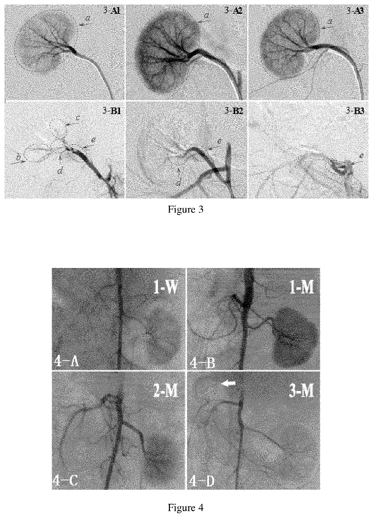 Embolism material for blood vessel, preparation method therefor and use thereof in preparation of drugs