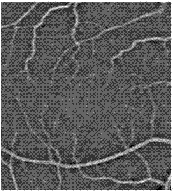 Mixed-region-based moving contour model image segmentation method