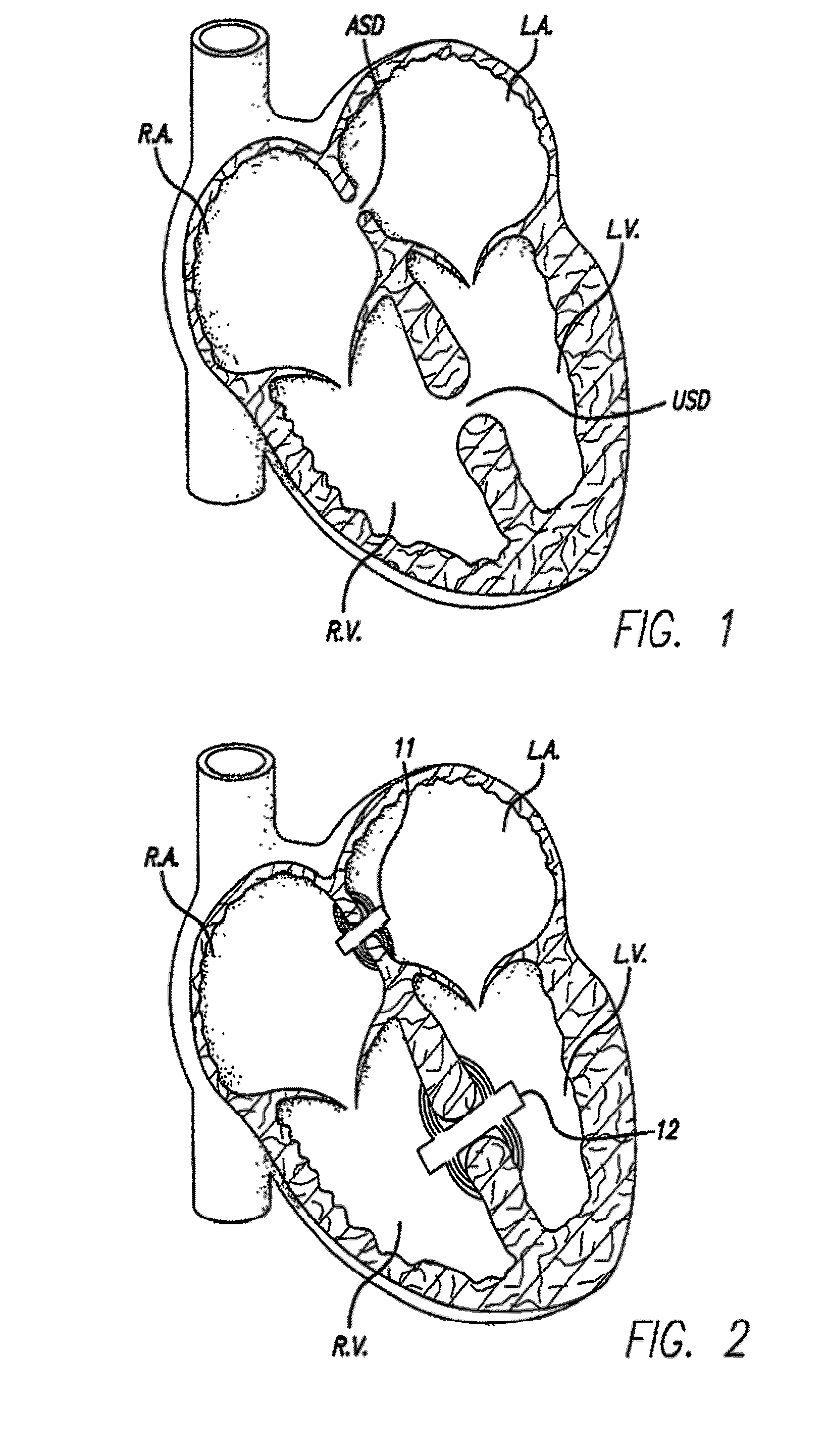 Methods and devices for delivering injections