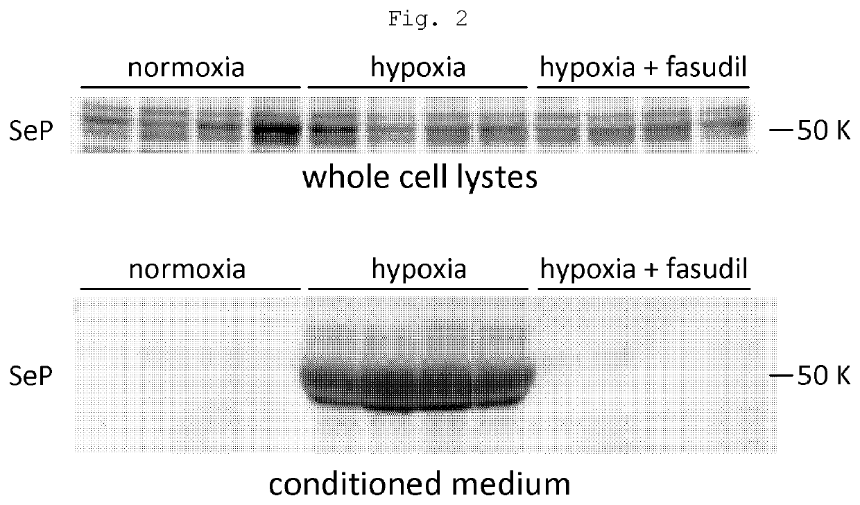 Method of testing for pulmonary hypertension