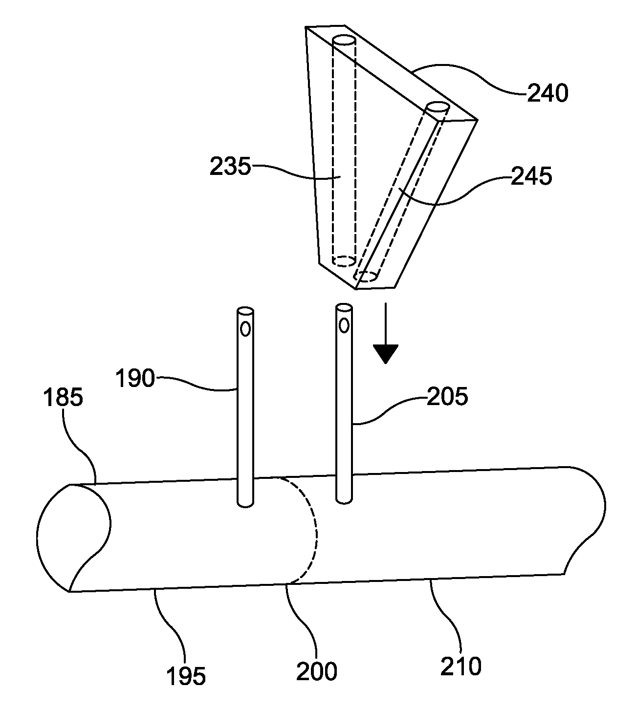 Osteotomy guide and method of using the same